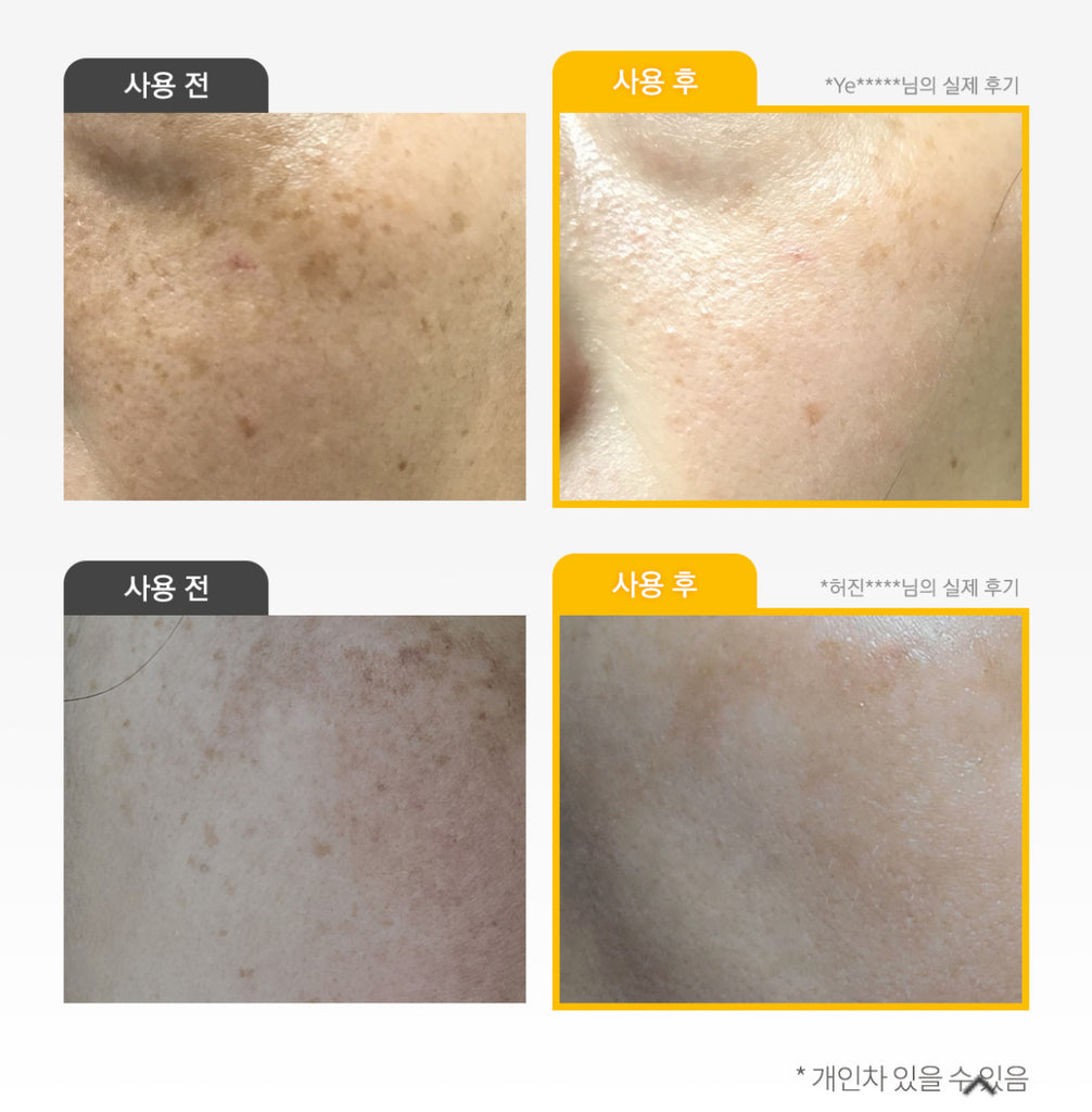 VARI HOPE 8 Days Vitamin C Serum